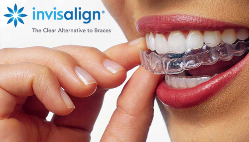 Invisalign in Merced, CA