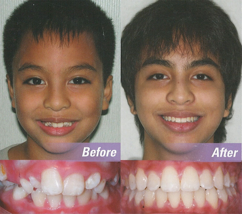 Orthodontics in Merced, CA